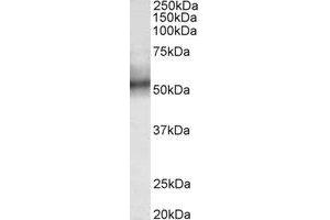 Western Blotting (WB) image for anti-Tripartite Motif Containing 11 (TRIM11) (Internal Region) antibody (ABIN2465007) (TRIM11 anticorps  (Internal Region))