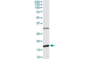 Immunoprecipitation of BIRC5 transfected lysate using anti-BIRC5 MaxPab rabbit polyclonal antibody and Protein A Magnetic Bead , and immunoblotted with BIRC5 purified MaxPab mouse polyclonal antibody (B01P) .