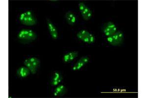 Immunofluorescence of purified MaxPab antibody to PAK1IP1 on HeLa cell. (PAK1IP1 anticorps  (AA 1-392))