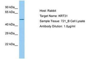 Image no. 1 for anti-Keratin 31 (KRT31) (AA 299-348) antibody (ABIN6750207) (Keratin 31 anticorps  (AA 299-348))