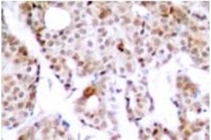 Image no. 1 for anti-Myc Proto-Oncogene protein (MYC) (pThr358) antibody (ABIN318074) (c-MYC anticorps  (pThr358))