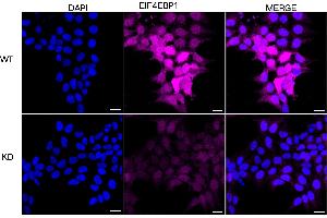 Immunocytochemical staining of HeLa cells using EIF4EBP1 antibody (ABIN7798532), 1:1,000), Top panel: wild-type (WT), Bottom panal: EIF4EBP1 shRNA knockdown (KD).