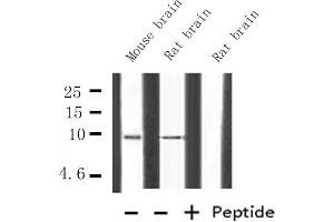 Western blot analysis of HMG17 expression in various lysates (HMGN2 anticorps  (Internal Region))