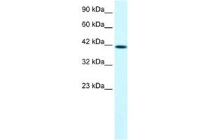 WB Suggested Anti-PTK2B Antibody Titration:  1. (PTK2B anticorps  (C-Term))
