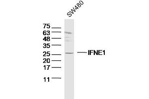 SW480 lysates probed with IFNE1 Polyclonal Antibody, Unconjugated  at 1:300 dilution and 4˚C overnight incubation. (IFNE anticorps  (AA 101-200))