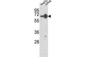 Western Blotting (WB) image for anti-Heterogeneous Nuclear Ribonucleoprotein L (HNRNPL) antibody (ABIN3001739) (HNRNPL anticorps)