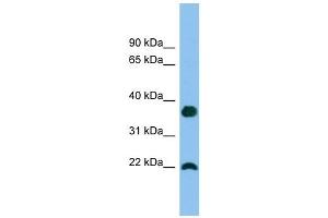 WFDC1 antibody used at 1 ug/ml to detect target protein.