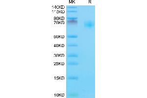 Mouse IL-18BP on Tris-Bis PAGE under reduced condition. (IL18BP Protein (AA 29-193) (Fc Tag))
