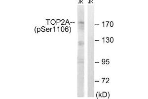 Western blot analysis of extracts from Jurkat cells, treated with paclitaxel (1uM, 24hours), using TOP2A (Phospho-Ser1106) antibody.