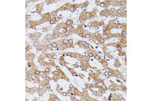 Immunohistochemistry of paraffin-embedded human liver using HDLBP antibody (ABIN6128051, ABIN6141701, ABIN6141702 and ABIN6221672) at dilution of 1:100 (40x lens).