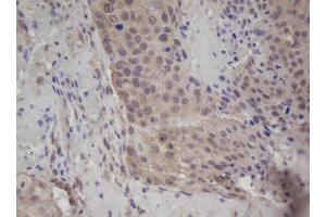 Image no. 1 for anti-Zinc Finger, AN1-Type Domain 5 (ZFAND5) antibody (ABIN1501811)