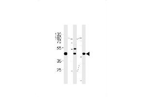 GTF2H2C Antibody (C-term) (ABIN655372 and ABIN2844928) western blot analysis in A549,K562,MCF-7 cell line lysates (35 μg/lane). (GTF2H2C anticorps  (C-Term))