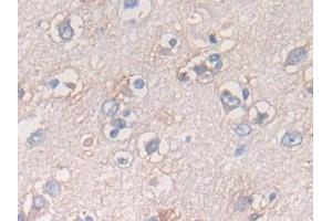 Detection of ATF6 in Human Cerebrum Tissue using Polyclonal Antibody to Activating Transcription Factor 6 (ATF6)