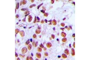 Immunohistochemical analysis of Histone H2A.