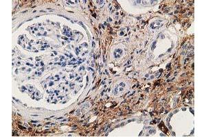 Image no. 9 for anti-Alcohol Dehydrogenase 1B (Class I), beta Polypeptide (ADH1B) antibody (ABIN1496477)