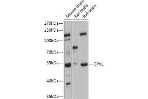 Western blot analysis of extracts of various cell lines, using CPVL antibody (ABIN6130825, ABIN6138985, ABIN6138987 and ABIN6215977) at 1:3000 dilution. (CPVL anticorps  (AA 127-476))