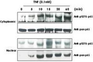Image no. 3 for anti-Nuclear Factor-kB p65 (NFkBP65) (pSer276) antibody (ABIN1103942) (NF-kB p65 anticorps  (pSer276))
