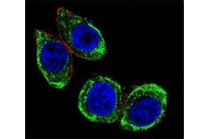 Confocal immunofluorescent analysis of Cytokeratin-18 antibody with HeLa cells followed by Alexa Fluor 488-conjugated goat anti-rabbit lgG (green).