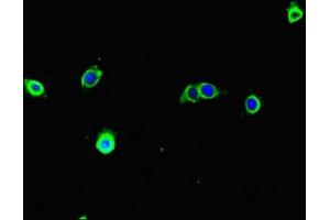 Immunofluorescent analysis of A375 cells using ABIN7171680 at dilution of 1:100 and Alexa Fluor 488-congugated AffiniPure Goat Anti-Rabbit IgG(H+L) (TECPR1 anticorps  (AA 199-487))