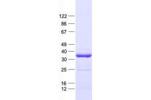 Validation with Western Blot
