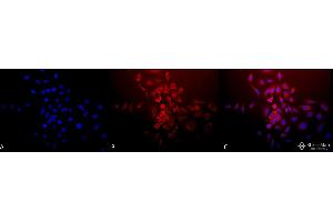 Immunocytochemistry/Immunofluorescence analysis using Rabbit Anti-SOD (Mn) Polyclonal Antibody .
