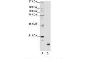 Image no. 1 for anti-Ribosomal Protein L32 (RPL32) (N-Term) antibody (ABIN203010) (RPL32 anticorps  (N-Term))