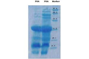 Lane 1: Catalogue ABIN1857612. (Prostate Specific Antigen Protein (PSA))