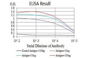 Black line: Control Antigen (100 ng),Purple line: Antigen (10 ng), Blue line: Antigen (50 ng), Red line:Antigen (100 ng)