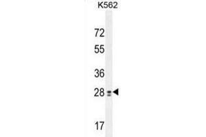 Western Blotting (WB) image for anti-Testis Expressed 13B (TEX13B) antibody (ABIN2995905) (TEX13B anticorps)