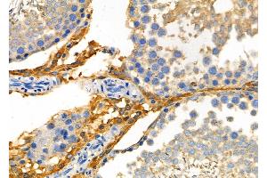 ABIN6260253 and ABIN6277781 at 1/100 staining Rat testis tissue by IHC-P.