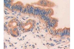 Detection of CA5B in Mouse Uterus Tissue using Polyclonal Antibody to Carbonic Anhydrase VB, Mitochondrial (CA5B)