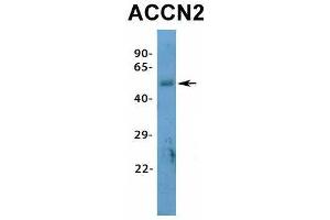 Host:  Rabbit  Target Name:  ACCN2  Sample Type:  Human Fetal Heart  Antibody Dilution:  1.