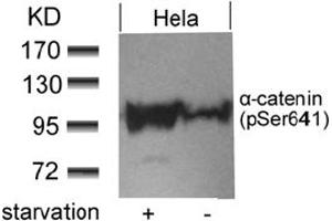 Image no. 1 for anti-Catenin (Cadherin-Associated Protein), alpha 1, 102kDa (CTNNA1) (pSer641) antibody (ABIN401554) (CTNNA1 anticorps  (pSer641))