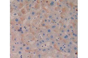 Used in DAB staining on fromalin fixed paraffin- embedded Kidney tissue
