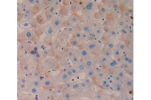 Used in DAB staining on fromalin fixed paraffin- embedded Kidney tissue (MTERF anticorps  (AA 1-191))