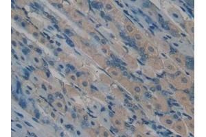 Detection of OC in Mouse Stomach Tissue using Polyclonal Antibody to Osteocalcin (OC)