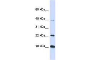 Image no. 1 for anti-Ubiquitin-Conjugating Enzyme E2D 2 (UBE2D2) (N-Term) antibody (ABIN6743143) (UBE2D2 anticorps  (N-Term))