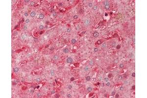 Human Liver: Formalin-Fixed, Paraffin-Embedded (FFPE). (SEMA3A anticorps  (AA 31-141) (FITC))