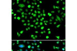 Immunofluorescence analysis of MCF-7 cells using PRKAG1 Polyclonal Antibody (PRKAG1 anticorps)