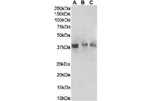 Western Blot using anti-HVEM antibody HMHV-1B18.