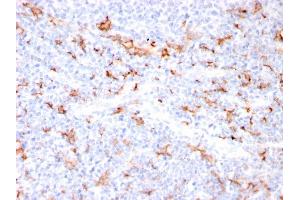 Formalin-fixed, paraffin-embedded human Tonsil stained with S100A8/A9 Complex Recombinant Rabbit Monoclonal Antibody (MAC3157R). (Recombinant S100A8 anticorps)
