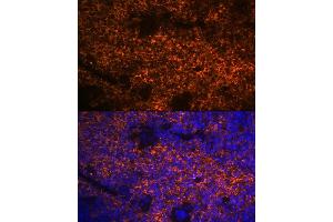 Immunofluorescence analysis of mouse spleen using Hemoglobin subunit alpha (HB) (HB) Rabbit mAb (ABIN7267608) at dilution of 1:100 (40x lens). (HBA1 anticorps)