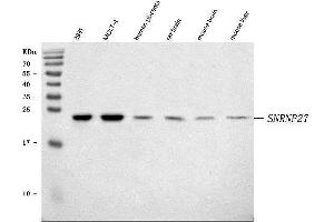 Western blot analysis of SNRNP27 using anti-SNRNP27 antibody (ABIN7599614). (SNRNP27 anticorps  (AA 100-155))
