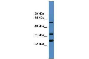 LRRFIP2 antibody used at 0. (LRRFIP2 anticorps  (N-Term))