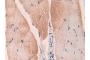 DAB staining on IHC-P; Samples: Mouse Skeletal muscle Tissue (LGMN anticorps  (AA 18-435))