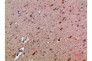 Immunohistochemical analysis of paraffin-embedded human-brain, antibody was diluted at 1:200