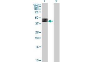 Lane 1: FUT1 transfected lysate ( 40. (FUT1 293T Cell Transient Overexpression Lysate(Denatured))