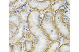 Immunohistochemistry of paraffin-embedded Mouse kidney using ARFGAP1 Polyclonal Antibody at dilution of 1:100 (40x lens). (ARFGAP1 anticorps)