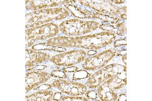 Immunohistochemistry of paraffin-embedded mouse spinal cord using SREBP2 Rabbit pAb (ABIN6128781, ABIN6148430, ABIN6148432 and ABIN6216892) at dilution of 1:50 (40x lens).