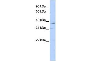Western Blotting (WB) image for anti-Nuclear Receptor Subfamily 1, Group I, Member 3 (NR1I3) antibody (ABIN2458945) (NR1I3 anticorps)